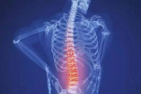 周杰伦都在被它 强直性脊椎炎 折磨,你还在弯腰驼背吗