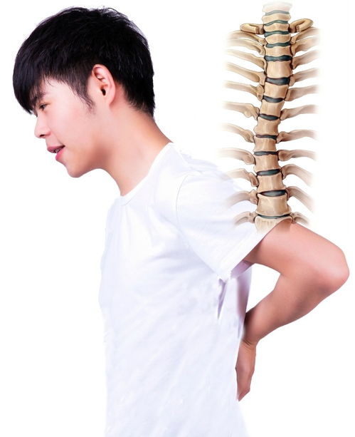 青少年腰疼需警惕强直性脊柱炎