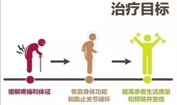 了解强直性脊柱炎 一种常见的风湿免疫病