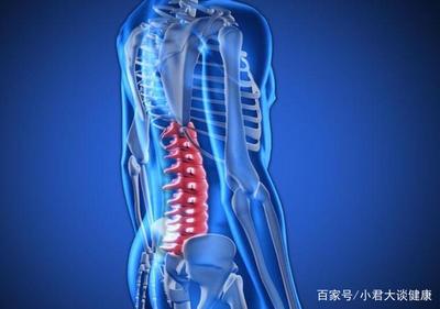 强直性脊柱炎的预防与健康管理