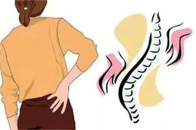 强直性脊柱炎的诊断方法与检查项目