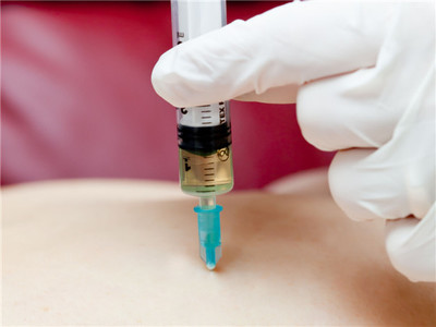 强直性脊柱炎的用药问题_飞华健康网