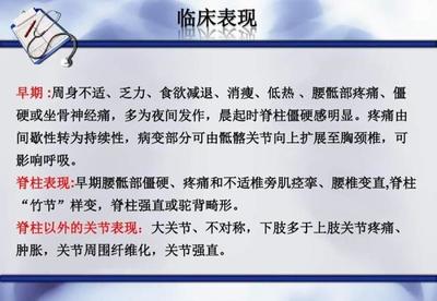 中医风湿病医院免疫吸附血液净化疗法治疗强直性脊柱炎效果与解析